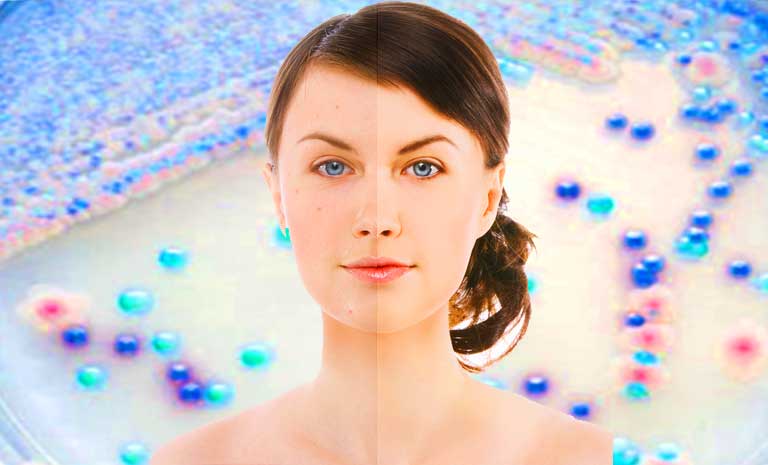 picture spotty face with blotchy complexion